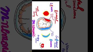 Mnemonic for Extradural hematoma vs Subdural hematoma for USMLE PLAB FCPS Medicine shorts viral [upl. by Yendys]