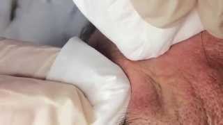 How To Remove a Whitehead Soft Sebum [upl. by Tisdale284]