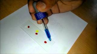 How To Test Your Own Blood Groups [upl. by Ear]