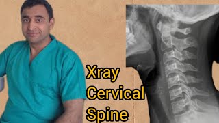 cervical spine x ray  cervical spine anatomy  how to interpret x ray neck  normal part 1 [upl. by Elleda]