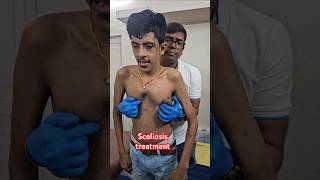 Scoliosis treatment drrajneeshkant worldfamouschiropractor [upl. by Ruscio]