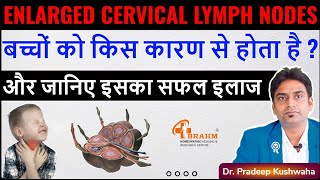 Enlarged cervical lymph nodes treatment  Cervical lymph nodes in child  lymphadenitis [upl. by Norling992]