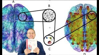 The Brain Connectome Explained Through Graph Theory Neurofeedback Implications [upl. by Husha]