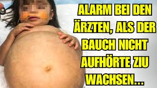 Alarm bei den Ärzten als der Bauch des Kindes nicht aufhöre zu wachsen [upl. by Nirre504]