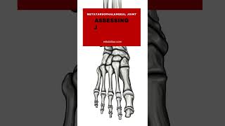 Assessing Joint Play Restrictions in the Metatarsophalangeal Joint  ErikDaltoncom [upl. by Amahs94]