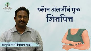 अंगाला खाज येणे पित्त उठणे यावर घरगुती आयुर्वेदिक उपाय  आयुर्वेदाचार्य विश्वास घाटगे [upl. by Airehtfele]