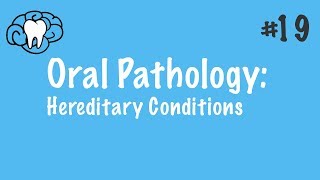 Oral Pathology  Hereditary Conditions  INBDE ADAT [upl. by Tibbitts777]