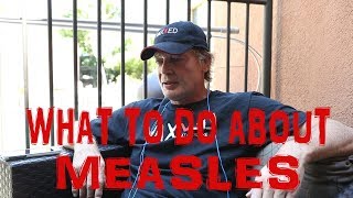 Dr Andrew Wakefield on What To Do About Measles [upl. by Aliek356]