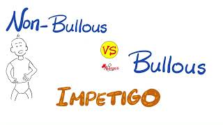 Impetigo  Nonbullous Impetigo vs Bullous Impetigo  Microbiology 🧫 and Infectious diseases 🦠 [upl. by Annej382]