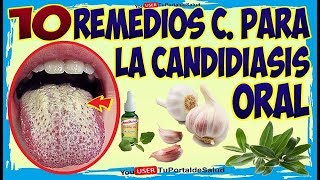 10 Remedios Caseros para la Candidiasis Oral – Como Combatir la Cándida en la Boca [upl. by Enailil]