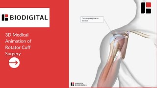 3D Medical Animation of a Rotator Cuff Surgery [upl. by Meijer]