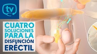 4 soluciones o tratamientos para la disfunción eréctil [upl. by Ijic]