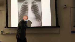 Chest xray positioning [upl. by Lacym]