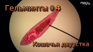 Гельминты 4 Кошачья двуустка Описторхоз  Helminths 4 Cat fluke Opisthorchiasis [upl. by Justino772]