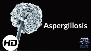 Aspergillosis Everything You Need To Know [upl. by Ahsinot]