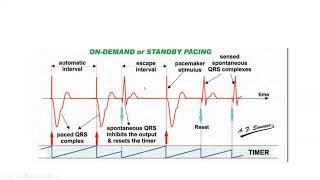 Pacemaker timing cycles and special features  Dr Mohamed Bayoumi [upl. by Eluj572]