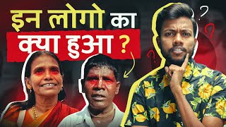 Kaccha Badam amp Ranu Mandal ये लोग का क्या हुआ [upl. by Ellenyl]