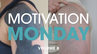 Full Bicep Blackout Tattoo Removal  Motivation Monday Volume 8  Removery [upl. by Eidnarb]