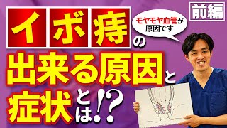 【前編】痔（イボ痔）の症状とモヤモヤ血管の関係性について医師が解説 痔の症状がなぜ起きるのかお尻の構造からイラストを用いて解説。実は、モヤモヤ血管が原因？！ [upl. by Enelez]