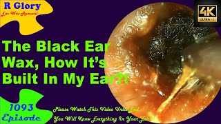 The Black Ear Wax🤦‍♀️How Was Its Built In My Ear🤷‍♂️New Video Ear Wax Removal 1093 ear health [upl. by Yentroc464]