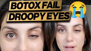 Botox Gone Wrong Droopy Eye  Cheap Fix [upl. by Merrilee]