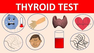 Thyroid function test TFT  Hypo and hyperthyroidism  symptoms amp diagnosis [upl. by Anikal]