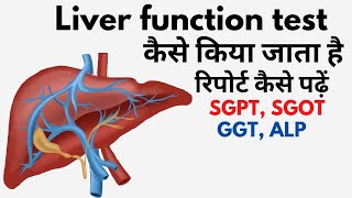 Liver function test in Hindi  lft blood test result in Hindi  lft normal range [upl. by Kahaleel]