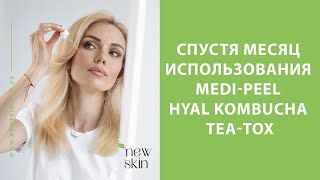 MediPeel Hyal Kombucha TeaTox Ampoule Cream Toner – отзыв и впечатления о новинке Меди Пил 2023 [upl. by Gwenette]