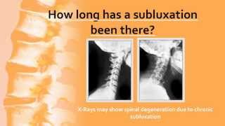 Health and Chiropractic Facts  Chiropractic Adjustments [upl. by Nylyram683]