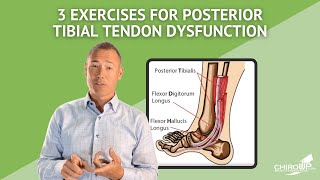 3 Exercises for Posterior Tibial Tendon Dysfunction [upl. by Immac]