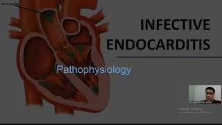 infective endocarditis  part 1   تم اضافة ال power point [upl. by Kielty]