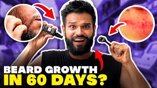 I Grew My Beard In 60 Days SHOCKING RESULTS  Beardo Beard Growth Challenge  BeYourBest San Kalra [upl. by Arakal363]