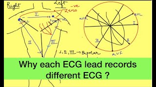 ECG leads placement physiology EKG  Unipolar and bipolar limb ecg leads Crdiovascular [upl. by Cirdet]