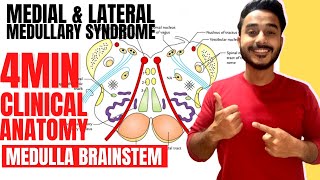 medulla oblongata clinical anatomy  medial medullary syndrome clinical anatomy of brainstem [upl. by Winsor]