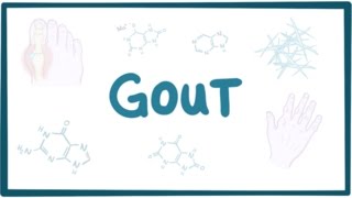 Gout  causes symptoms diagnosis treatment pathology [upl. by Anes357]