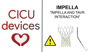 IMPELLA AND TAVRTAVI INTERACTION ALSO FOR SUTURELESS AND CALCIFIED AORTIC VALVES [upl. by Beeson475]