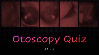 Otoscopy Quiz 1  5 [upl. by Inaflahk]