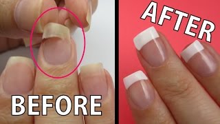 REPAIR A RIPPED NAIL FAST [upl. by Aznaed]