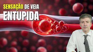 Doutor Revela Verdade Sobre Veias Entupidas [upl. by Pauiie713]