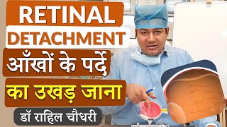 Retinal Detachment  आँख के पर्दे का अपनी जगह से हट जाना  Cause Symptoms Diagnosis and Treatment [upl. by Ednalrim350]