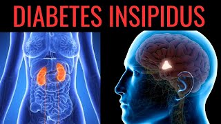 What is Diabetes Insipidus Symptoms Causes Treatment [upl. by Yelreveb]