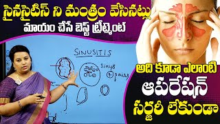 Best Treatment For Chronic Sinusitis  Sinus Headaches  Best Home Remedies For Sinus QubeTVHealth [upl. by Ayotas621]