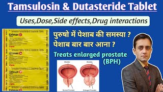 Tamsulosin hydrochloride and dutasteride tablet uses dose side effects in hindi  Urimax d tablet [upl. by Erapsag]