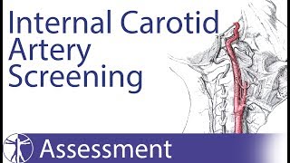 Carotid Artery Insufficiency  PreManipulative Screening [upl. by Aitel]