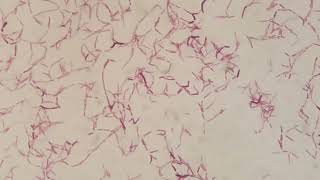 Modified AcidFast Staining of Nocardia Diagnostic Techniques and Clinical Significance [upl. by Tollman523]