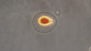 Haematococcus pluvialis the green algae that turn red [upl. by Oinegue184]