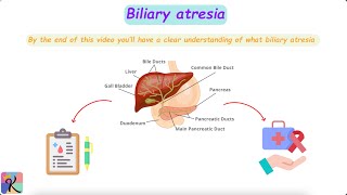 Understanding Biliary Atresia – Causes Diagnosis and Treatment [upl. by Fee]