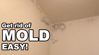 How to Get Rid of Mold in the Bathroom Easy [upl. by Suertemed708]