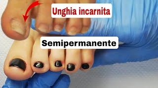 Pedicure unghie incarnite semipermanente [upl. by Haelem]