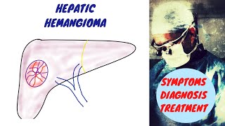 Hepatic Hemangioma  Liver Hemangioma [upl. by Atekram511]